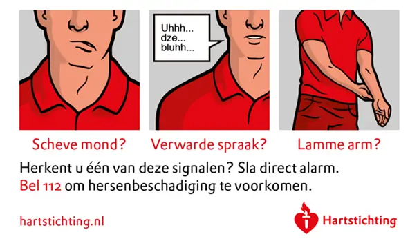 CVA vraagt aandacht voor de Dag van de Beroerte